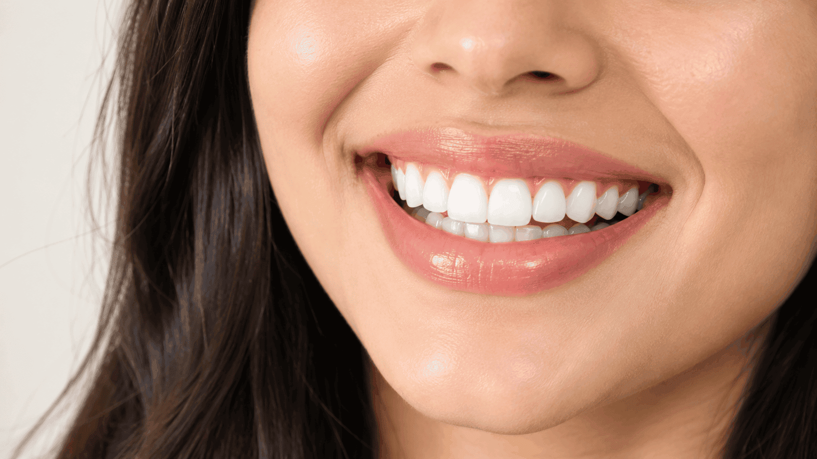 Smiling patient showing dental veneers results